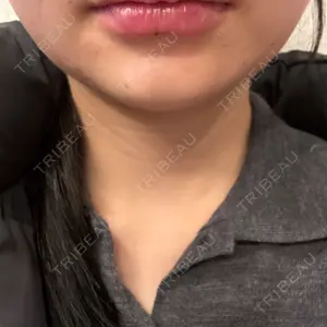 BiBiクリニック口コミ