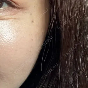 APスキンクリニック銀座口コミ