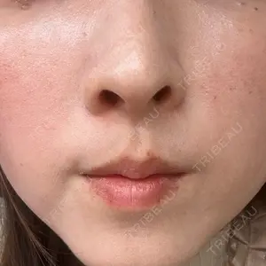 BITO BEAUTY CLINIC BITO BEAUTY CLINIC口コミ