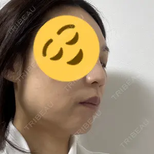 TCB東京中央美容外科 TCB東京中央美容外科 神戸院口コミ