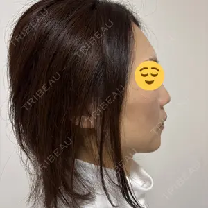 TCB東京中央美容外科 TCB東京中央美容外科 神戸院口コミ