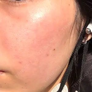 心斎橋なんばRINBEAUTYCLINIC美容皮膚科美容外科 RIN BEAUTY CLINIC口コミ
