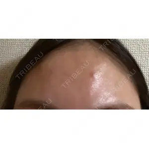 CZEN CLINIC 銀座院口コミ