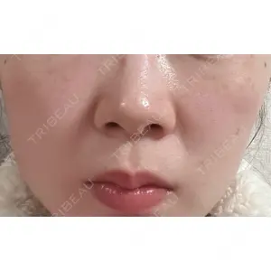 トラスト美容クリニック トラスト美容クリニック 銀座院口コミ