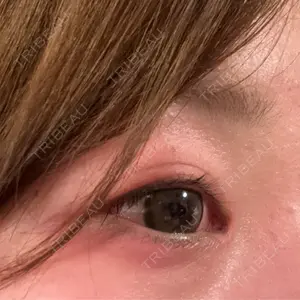 東京シンデレラ美容外科 東京シンデレラ美容外科 池袋院口コミ