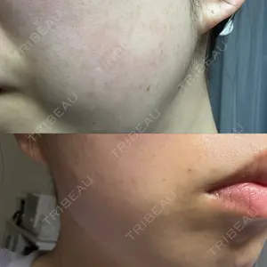CZEN CLINIC 銀座院口コミ