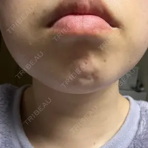 CZEN CLINIC 銀座院口コミ