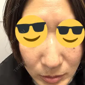 東京シルククリニック 東京シルククリニック 新宿院口コミ