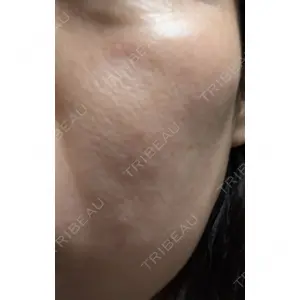 ヴェリテクリニック ヴェリテクリニック 名古屋院口コミ