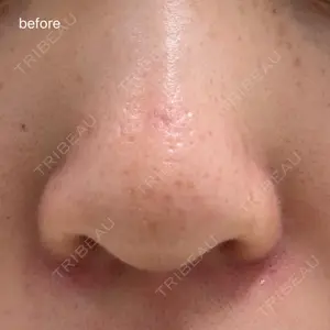 日本美容・医療クリニック 日本美容・医療クリニック 六本木院口コミ