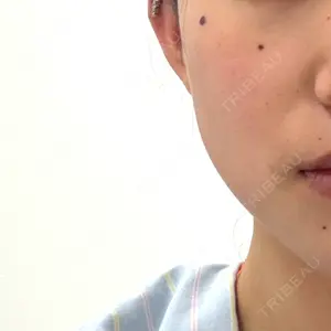 ルラ美容クリニック ルラ美容クリニック 大阪本院口コミ