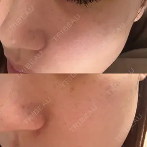 ライズワン美容皮膚科クリニック口コミ