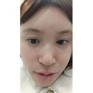 NARU Beauty Clinic NARU Beauty Clinic 【ナルクリ】 水戸院口コミ