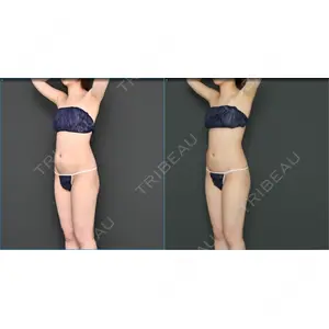 Lipo Clinic omotesando口コミ