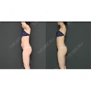 Lipo Clinic omotesando口コミ