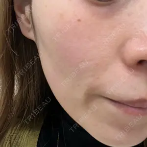 新宿Ladies&Gentlemen美容クリニック口コミ