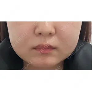 ビラビューティークリニック 博多美容外科/美容皮膚科 ビラビューティークリニック口コミ