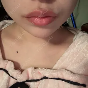 L‘amour clinic Tokyo【ラムールクリニック東京】口コミ