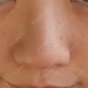 PRISM Beauty Clinic  PRISM Beauty Clinic 新宿院口コミ