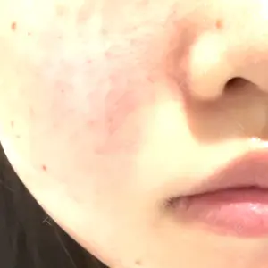 APスキンクリニック銀座口コミ