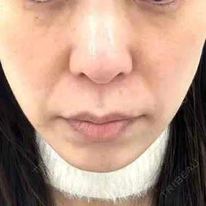 APスキンクリニック銀座口コミ