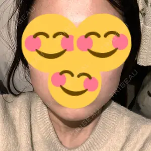 ルラ美容クリニック ルラ美容クリニック 郡山院口コミ