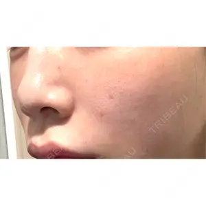 ビラビューティークリニック 博多美容外科/美容皮膚科 ビラビューティークリニック口コミ