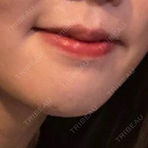 表参道ウィズ・クリニック口コミ