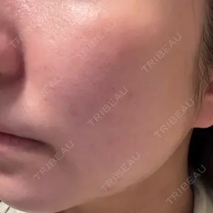 やさしい美容皮膚科・皮フ科 やさしい美容皮膚科・皮フ科　秋葉原院口コミ