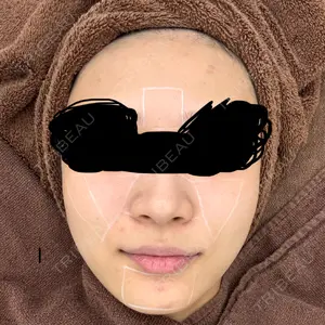 CHARIS BEAUTY CLINIC口コミ