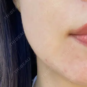心斎橋なんばRINBEAUTYCLINIC美容皮膚科美容外科 RIN BEAUTY CLINIC口コミ