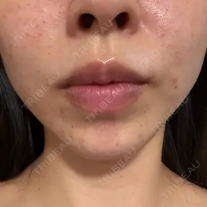 APスキンクリニック銀座口コミ
