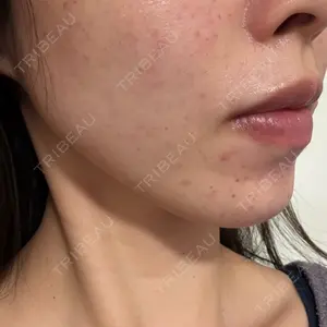 APスキンクリニック銀座口コミ
