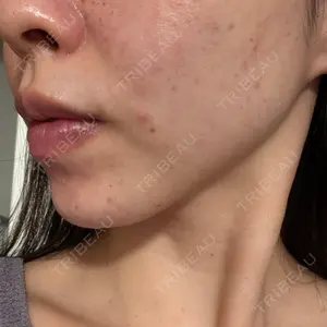 APスキンクリニック銀座口コミ