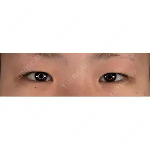 アリエル美容クリニック アリエル美容クリニック 水戸院口コミ