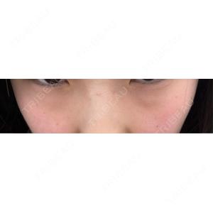TCB東京中央美容外科 TCB東京中央美容外科 渋谷西口院口コミ