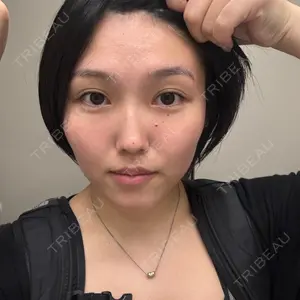 やさしい美容皮膚科・皮フ科 やさしい美容皮膚科・皮フ科　秋葉原院口コミ