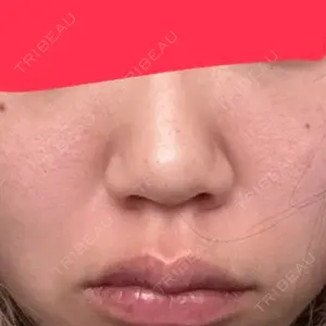 DIAV（ディアブ） クリニック口コミ