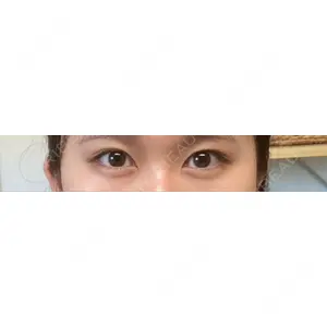 Nebula Clinic 新宿美容外科ネビュラクリニック口コミ