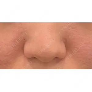 GLANZ CLINIC口コミ