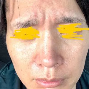 TCB東京中央美容外科 TCB東京中央美容外科 豊田院口コミ