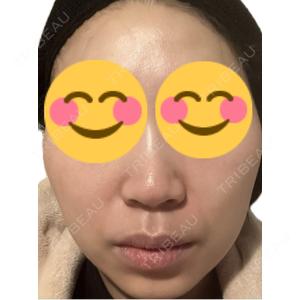 エルムクリニック 美容皮膚科エルムクリニック 麻布院口コミ