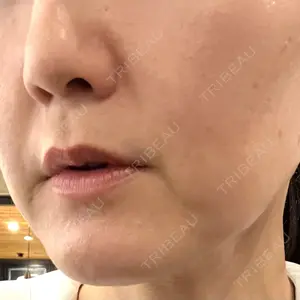 メディアージュクリニック メディアージュクリニック 大阪梅田院口コミ