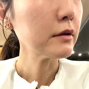 メディアージュクリニック メディアージュクリニック 大阪梅田院口コミ