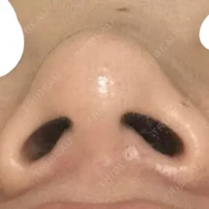 口コミ