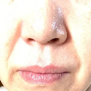 ON-CLINIC Beauty口コミ