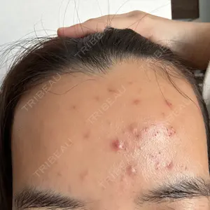 日本美容・医療クリニック 日本美容・医療クリニック 六本木院口コミ