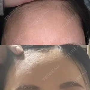 PRISM Beauty Clinic  PRISM Beauty Clinic 新宿院口コミ