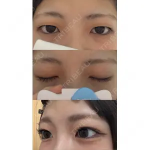 共立美容外科・歯科 共立美容外科 大宮院口コミ