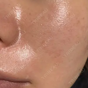 ビラビューティークリニック 博多美容外科/美容皮膚科 ビラビューティークリニック口コミ